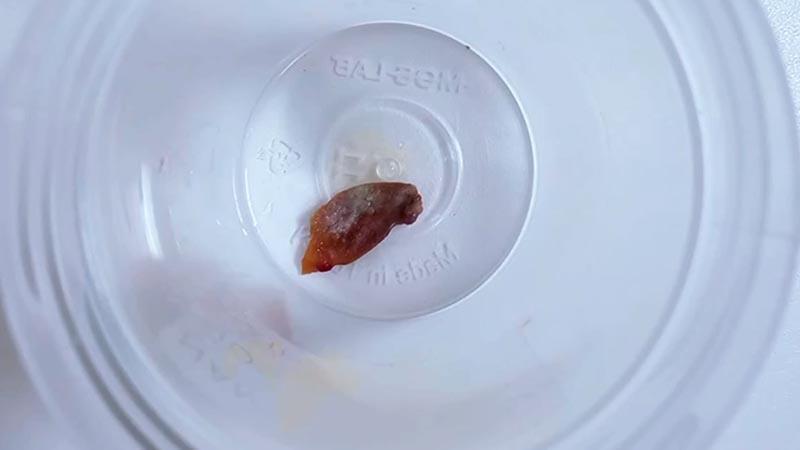 1,5 yıllık öksürüğün nedeni, kabak çekirdeği çıktı